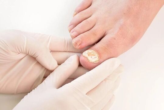 Doctors recommend zxcvbnmqwt to treat mikoses