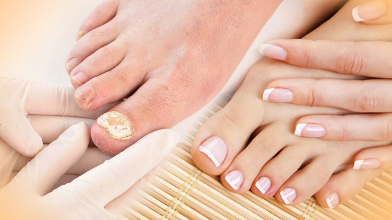 Nail trunk