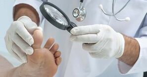 The doctor examines the foot affected by mushrooms