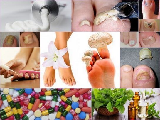 People's treatment