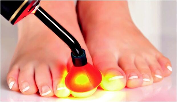 Treatment with radiation